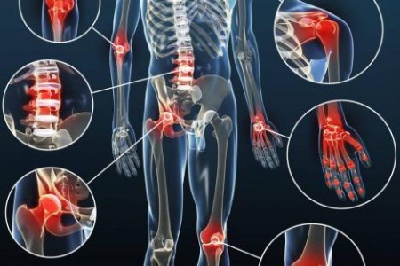 АРТРИТ СИМПТОМИ. ВИДОВЕ АРТРИТ. ЛЕКАРСТВА ЗА АРТРИТ АРТРИТ СИМПТОМИ. ВИДОВЕ АРТРИТ. ЛЕКАРСТВА ЗА АРТРИТ
