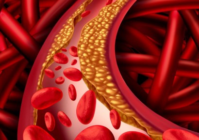 ДЕВЕТ НАЧИНА ДА СВАЛИМ ХОЛЕСТЕРОЛА