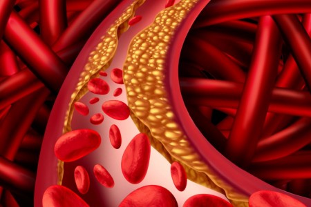 ДЕВЕТ НАЧИНА ДА СВАЛИМ ХОЛЕСТЕРОЛА