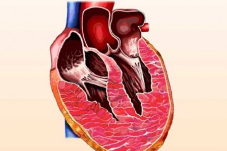 УГОЛЕМЕНО СЪРЦЕ : РИСКОВЕ, ДИАГНОЗА, ЛЕЧЕНИЕ УГОЛЕМЕНО СЪРЦЕ : РИСКОВЕ, ДИАГНОЗА, ЛЕЧЕНИЕ