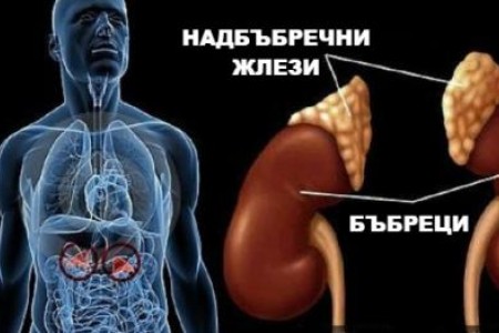 АДЕНОМ НА НАДБЪБРЕЧНАТА ЖЛЕЗА - ЛЕЧЕНИЕ И ПРОФИЛАКТИКА