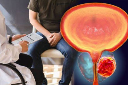 УМИРА ЛИ СЕ ОТ РАК НА ПРОСТАТАТА | РАК НА ПРОСТАТАТА ЛЕЧЕНИЕ