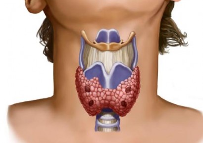 БИЛКИ ЗА ЩИТОВИДНАТА ЖЛЕЗА | ЩИТОВИДНА ЖЛЕЗА ЛЕЧЕНИЕ