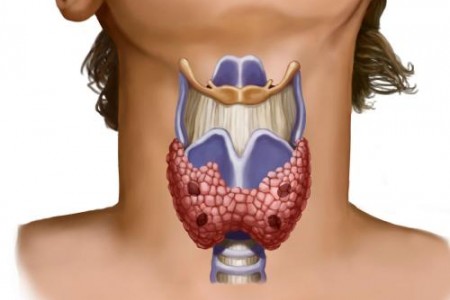 БИЛКИ ЗА ЩИТОВИДНАТА ЖЛЕЗА | ЩИТОВИДНА ЖЛЕЗА ЛЕЧЕНИЕ