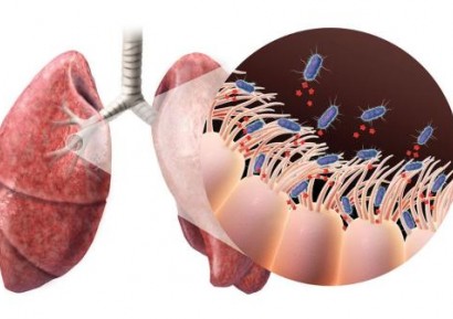 МАГАРЕШКА КАШЛИЦА | КОКЛЮШ СИМПТОМИ | ЛЕЧЕНИЕ НА КОКЛЮШ