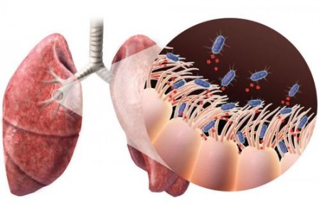 МАГАРЕШКА КАШЛИЦА | КОКЛЮШ СИМПТОМИ | ЛЕЧЕНИЕ НА КОКЛЮШ
