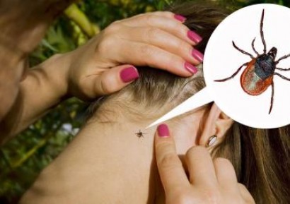 УХАПВАНЕ ОТ КЪРЛЕЖ | ЛАЙМСКА БОЛЕСТ | ЕНЦЕФАЛИТ | ЛЕЧЕНИЕ