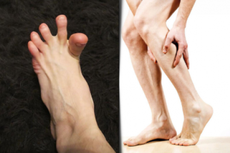 КРАМПИ В КРАКАТА - НАРОДНО ЛЕЧЕНИЕ НА КРАМПИ