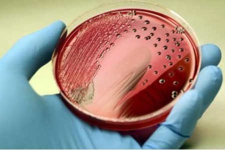 СЕПСИС СИМПТОМИ | ПРИЧИНИ | СМЪРТ ОТ СЕПСИС | КАК СЕ ЛЕКУВА