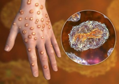 НОВИЯТ ЩАМ НА МАЙМУНСКА ШАРКА АТАКУВА ХОМОСЕКСУАЛНИТЕ МЪЖЕ