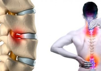 ОБЛЕГЧАВАНЕ НА БОЛКИ ПРИ ДИСКОВА ХЕРНИЯ | ЛЕКАРСТВА И БИЛКИ