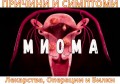 МИОМА НА МАТКАТА | СИМПТОМИ - ЛЕКАРСТВА, ОПЕРАЦИИ И БИЛКИ