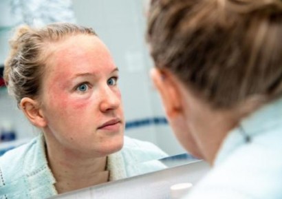 АТОПИЧЕН ДЕРМАТИТ | ЛЕЧЕНИЕ ПРИ БЕБЕТА И ВЪЗРАСТНИ