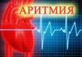 АРИТМИЯ НА СЪРЦЕТО - ПРИЧИНИ, ВИДОВЕ И ЛЕЧЕНИЕ АРИТМИЯ НА СЪРЦЕТО - ПРИЧИНИ, ВИДОВЕ И ЛЕЧЕНИЕ