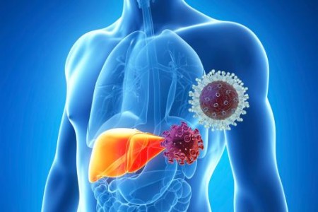 ХЕПАТИТ СИМПТОМИ | ХРОНИЧЕН ХЕПАТИТ | БИЛКИ ЗА ЧЕРЕН ДРОБ