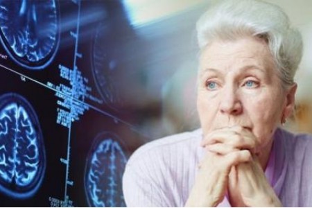 КАКВО Е АЛЦХАЙМЕР И КОЛКО ЖИВЕЯТ БОЛНИТЕ?