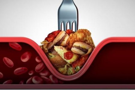 ВИСОК ХОЛЕСТЕРОЛ - КАК ДА ГО СВАЛИМ У ДОМА БЕЗ ЛЕКАРСТВА?