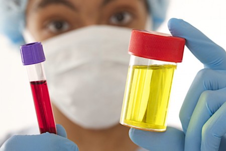 КАКВО СЕ ПИЕ ПРИ КРЪВ В УРИНАТА | ЛЕЧЕНИЕ НА ХЕМАТУРИЯ