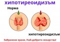ХИПОТИРЕОИДИЗЪМ СИМПТОМИ | ЗАБРАНЕНИ ХРАНИ | КАК СЕ ЛЕКУВА