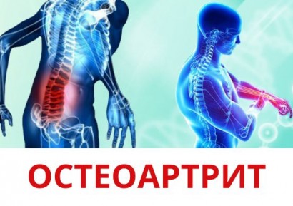 ДИЕТА ПРИ ОСТЕОАРТРИТ | НАЙ-ДОБРОТО ЛЕЧЕНИЕ НА ОСТЕОАРТРИТ