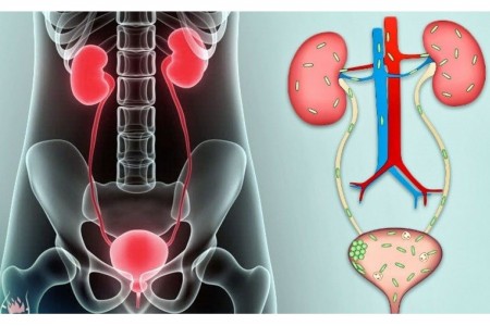 ВЪЗПАЛЕНИЕ НА ПИКОЧНИТЕ ПЪТИЩА | 9 НАЧИНА ЗА ПРЕВЕНЦИЯ