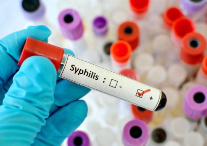 СИФИЛИС СИМПТОМИ | ЛЕЧЕНИЕ И ИЗСЛЕДВАНИЯ | КАК СЕ ПРЕДАВА