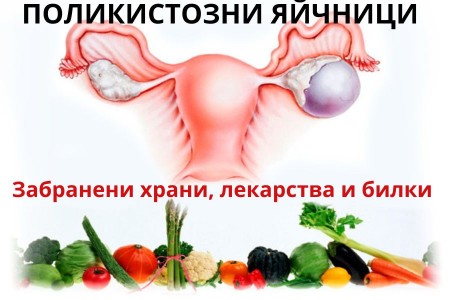 ПОЛИКИСТОЗНИ ЯЙЧНИЦИ | ЗАБРАНЕНИ ХРАНИ, ЛЕКАРСТВА И БИЛКИ