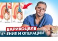 ВАРИКОЦЕЛЕ - ПРИЧИНИ И СИМПТОМИ | ОПЕРАТИВНО ЛЕЧЕНИЕ