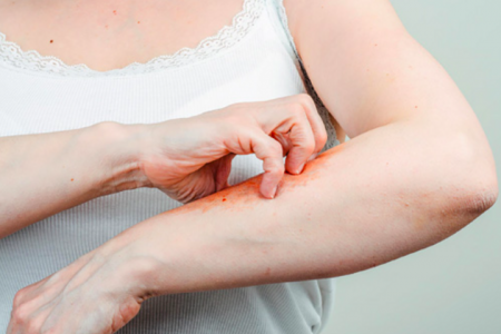 НАРОДНА МЕДИЦИНА ЗА СЪРБЕЖ ПО ТЯЛОТО | БИЛКИ И ЛЕКАРСТВА