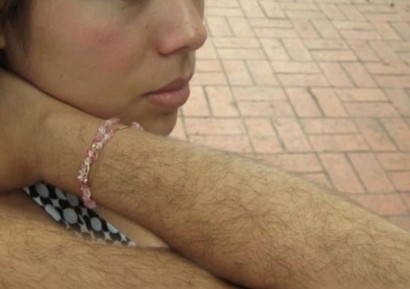 ХИРЗУТИЗЪМ - ПРЕКОМЕРНО ОКОСМЯВАНЕ | ЛЕКАРСТВА И БИЛКИ