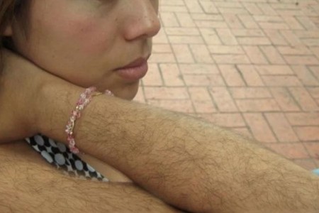 ХИРЗУТИЗЪМ - ПРЕКОМЕРНО ОКОСМЯВАНЕ | ЛЕКАРСТВА И БИЛКИ