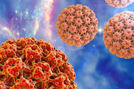 ЛЕСНО ПРЕМАХВАНЕ НА ПАПИЛОМИ | ЛЕПЕНКИ, ЛЕКАРСТВА, БИЛКИ