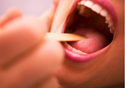 КОЛКО ВРЕМЕ ПРОДЪЛЖАВА ГНОЙНА АНГИНА? СИМПТОМИ И ЛЕЧЕНИЕ