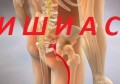 НАЙ-ДОБРИТЕ ЛЕКАРСТВА ПРИ ИШИАС | СИМПТОМИ И ЛЕЧЕНИЕ