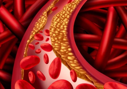 ДЕВЕТ НАЧИНА ДА СВАЛИМ ХОЛЕСТЕРОЛА