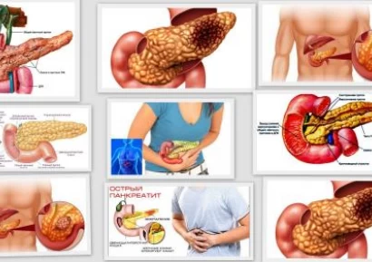 ПЪРВИ СИМПТОМИ НА ПАНКРЕАТИТ. ЛЕЧЕНИЕ НА ПАНКРЕАТИТ. ДИЕТА