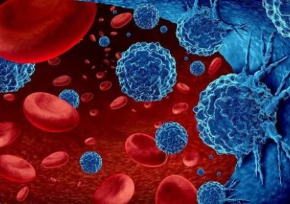 ЛЕВКЕМИЯ СИМПТОМИ. ЛЕВКЕМИЯ ПРИ ДЕЦАТА. ВИДОВЕ И ЛЕЧЕНИЕ