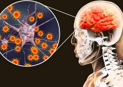 СИМПТОМИ НА МЕНИНГИТ. ЛЕЧЕНИЕ НА МЕНИНГИТ. ВИДОВЕ МЕНИНГИТ