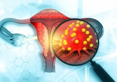РАК НА ЯЙЧНИЦИТЕ СИМПТОМИ | ТУМОРНИ МАРКЕРИ | ЛЕЧЕНИЕ