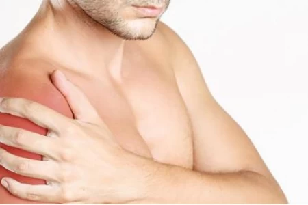 БУРСИТ НА РАМОТО | БУРСИТ НА КОЛЯНОТО | ЛЕКАРСТВА ЗА БУРСИТ