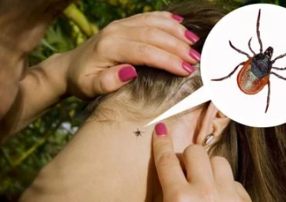 УХАПВАНЕ ОТ КЪРЛЕЖ | ЛАЙМСКА БОЛЕСТ | ЕНЦЕФАЛИТ | ЛЕЧЕНИЕ