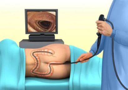 КОЛОНОСКОПИЯ |ЦЕНИ НА КОЛОНОСКОПИЯ |ВИРТУАЛНА КОЛОНОСКОПИЯ