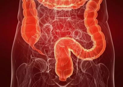 КОЛИТ СИМПТОМИ | ХАПЧЕТА ЗА КОЛИТ | БАБИНИ РЕЦЕПТИ