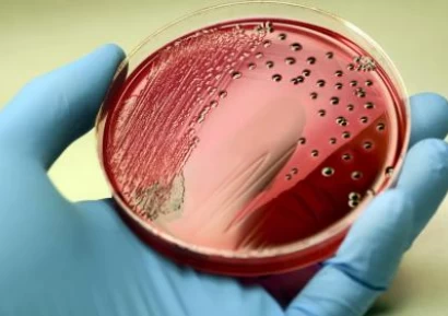 СЕПСИС СИМПТОМИ | ПРИЧИНИ | СМЪРТ ОТ СЕПСИС | КАК СЕ ЛЕКУВА