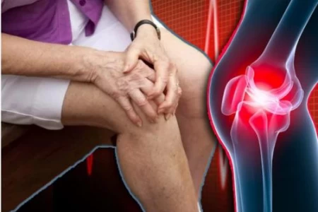 БОЛКИ В КОЛЕНАТА - КАК ДА СЕ ОТЪРВЕМ ОТ БОЛКИТЕ В КОЛЕНАТА?