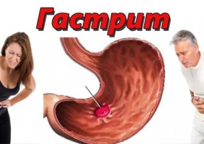 ГАСТРИТ СИМПТОМИ | КЪДЕ БОЛИ ГАСТРИТ | ХАПЧЕТА ЗА ГАСТРИТ