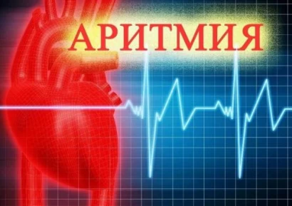 АРИТМИЯ НА СЪРЦЕТО - ПРИЧИНИ, ВИДОВЕ И ЛЕЧЕНИЕ