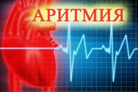 АРИТМИЯ НА СЪРЦЕТО - ПРИЧИНИ, ВИДОВЕ И ЛЕЧЕНИЕ