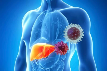 ХЕПАТИТ СИМПТОМИ | ХРОНИЧЕН ХЕПАТИТ | БИЛКИ ЗА ЧЕРЕН ДРОБ