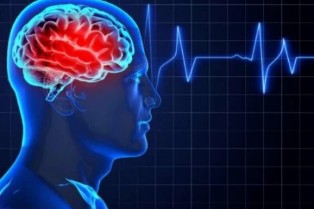 ИНСУЛТ СИМПТОМИ | ИСХЕМИЧЕН ИНСУЛТ | ХЕМОРАГИЧЕН ИНСУЛТ